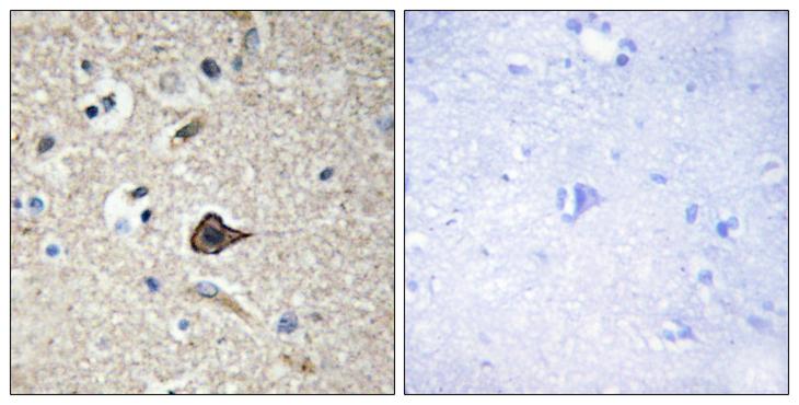 TNFSF12 / TWEAK Antibody - Peptide - + Immunohistochemistry analysis of paraffin-embedded human brain tissue using TNF12 antibody.