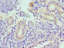 TNFSF13 / APRIL Antibody - Immunohistochemistry of paraffin-embedded human pancreas using antibody at 1:100 dilution.