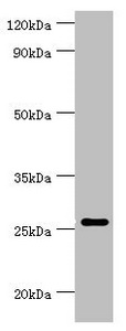 TNFSF13 / APRIL Antibody - Western blot All lanes: Tumor necrosis factor ligand superfamily member 13 antibody at 10µg/ml + Hela whole cell lysate Secondary Goat polyclonal to rabbit IgG at 1/10000 dilution Predicted band size: 28, 26, 25, 37, 23 kDa Observed band size: 28 kDa