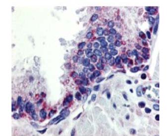 TNFSF13 / APRIL Antibody - Detection of APRIL in human prostate