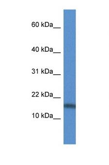 TNFSF13 / APRIL Antibody - TNFSF13 / APRIL antibody Western blot of HCT15 Cell lysate. Antibody concentration 1 ug/ml.  This image was taken for the unconjugated form of this product. Other forms have not been tested.