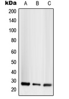 TNFSF13 / APRIL Antibody - Western blot analysis of CD256 expression in HEK293T (A); SP2/0 (B); H9C2 (C) whole cell lysates.