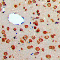 TNFSF13 / APRIL Antibody - Immunohistochemical analysis of CD256 staining in human brain formalin fixed paraffin embedded tissue section. The section was pre-treated using heat mediated antigen retrieval with sodium citrate buffer (pH 6.0). The section was then incubated with the antibody at room temperature and detected using an HRP conjugated compact polymer system. DAB was used as the chromogen. The section was then counterstained with hematoxylin and mounted with DPX.