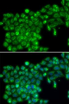 TNFSF13 / APRIL Antibody - Immunofluorescence analysis of MCF7 cells.