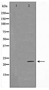 TNFSF13 / APRIL Antibody - Western blot of HeLa cell lysate using TALL-2 Antibody