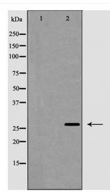 TNFSF13 / APRIL Antibody - Western blot of TALL-2 expression in COLO205 cells