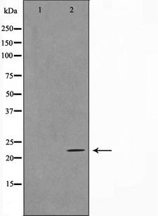 TNFSF13 / APRIL Antibody - Western blot analysis on HeLa cell lysates using TALL-2 antibody. The lane on the left is treated with the antigen-specific peptide.