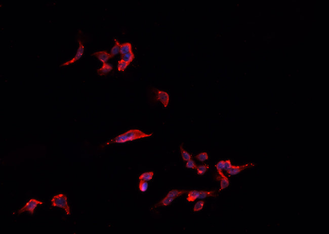TNFSF13 / APRIL Antibody - Staining HeLa cells by IF/ICC. The samples were fixed with PFA and permeabilized in 0.1% Triton X-100, then blocked in 10% serum for 45 min at 25°C. The primary antibody was diluted at 1:200 and incubated with the sample for 1 hour at 37°C. An Alexa Fluor 594 conjugated goat anti-rabbit IgG (H+L) Ab, diluted at 1/600, was used as the secondary antibody.
