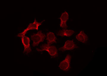 TNFSF13 / APRIL Antibody