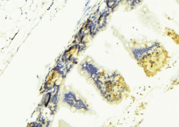 TNFSF13 / APRIL Antibody - 1:100 staining mouse colon tissue by IHC-P. The sample was formaldehyde fixed and a heat mediated antigen retrieval step in citrate buffer was performed. The sample was then blocked and incubated with the antibody for 1.5 hours at 22°C. An HRP conjugated goat anti-rabbit antibody was used as the secondary.