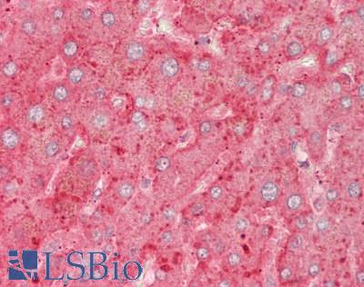TNFSF14 / LIGHT Antibody - Human Liver: Formalin-Fixed, Paraffin-Embedded (FFPE).  This image was taken for the unconjugated form of this product. Other forms have not been tested.