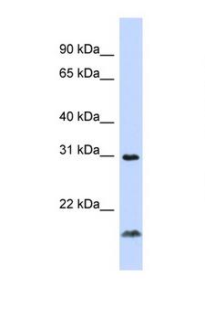 TNFSF14 / LIGHT Antibody - TNFSF14 / LIGHT antibody Western blot of 721_B Cell lysate. Antibody concentration 1 ug/ml. This image was taken for the unconjugated form of this product. Other forms have not been tested.