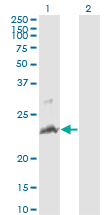TNFSF14 / LIGHT Antibody - Western blot of TNFSF14 expression in transfected 293T cell line by TNFSF14 monoclonal antibody (M01), clone 4E3.