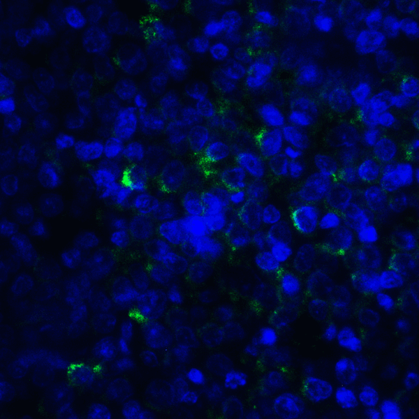 TNFSF14 / LIGHT Antibody - Immunofluorescence of LIGHT in human lymphoma tissue with LIGHT antibody at 20 ug/mL. Green: LIGHT Antibody [7B9E12] Blue: DAPI staining