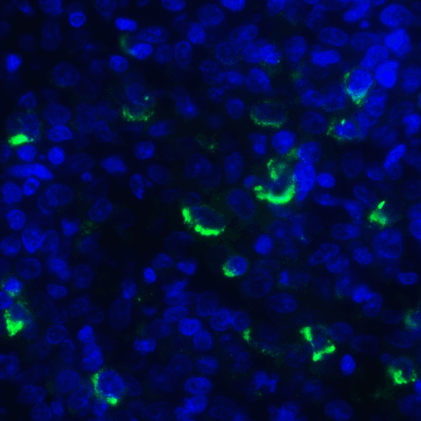 TNFSF14 / LIGHT Antibody - Immunofluorescence of LIGHT in human lymphoma tissue with LIGHT antibody at 20 ug/mL. Green: LIGHT Antibody [7B9F12] Blue: DAPI staining