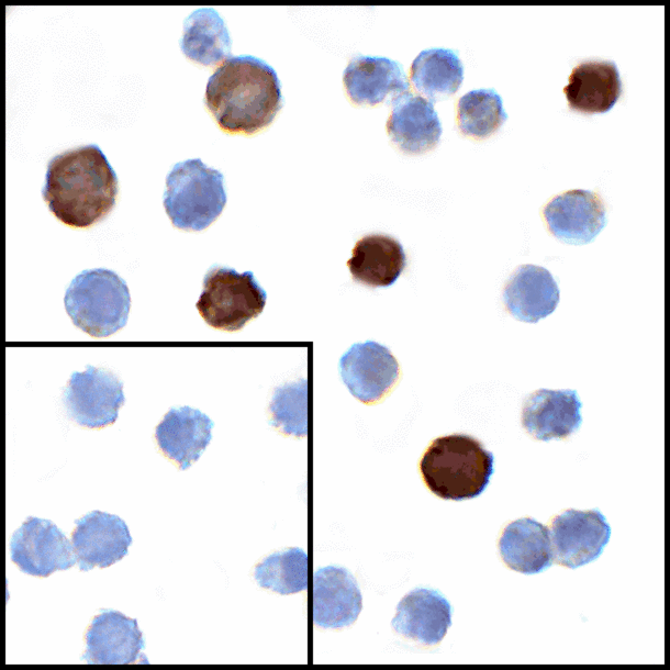 TNFSF14 / LIGHT Antibody - Immunocytochemistry of LIGHT in transfected HEK293 cells with LIGHT antibody at 1 ug/mL. Lower left: Immunocytochemistry in transfected HEK293 cells with control mouse IgG antibody at 1 ug/mL.