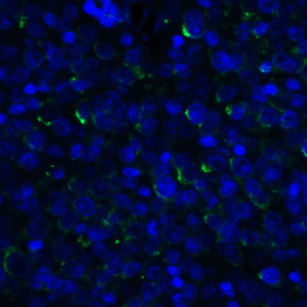 TNFSF14 / LIGHT Antibody - Immunofluorescence of LIGHT in human lymphoma tissue with LIGHT antibody at 20 ug/mL. Green: LIGHT Antibody [7B9H9] Blue: DAPI staining
