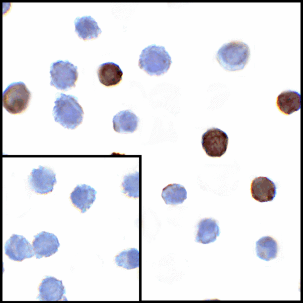 TNFSF14 / LIGHT Antibody - Immunocytochemistry of LIGHT in transfected HEK293 cells with LIGHT antibody at 1 ug/mL. Lower left: Immunocytochemistry in transfected HEK293 cells with control mouse IgG antibody at 1 ug/mL.