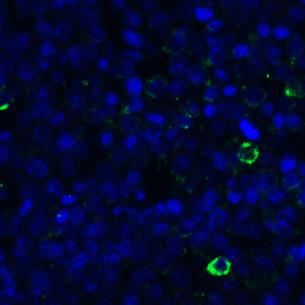 TNFSF14 / LIGHT Antibody - Immunofluorescence of LIGHT in human lymphoma tissue with LIGHT antibody at 20 ug/mL. Green: LIGHT Antibody [8D4] Blue: DAPI staining