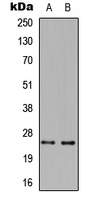 TNFSF14 / LIGHT Antibody - Western blot analysis of CD258 expression in HeLa (A); Raw264.7 (B) whole cell lysates.