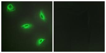TNFSF14 / LIGHT Antibody - Peptide - + Immunofluorescence analysis of HeLa cells, using TNF14 antibody.