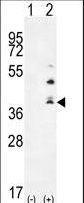 TNFSF15 / TL1A / VEGI Antibody - Western blot of TNFSF15 (arrow) using rabbit polyclonal TNFSF15 Antibody. 293 cell lysates (2 ug/lane) either nontransfected (Lane 1) or transiently transfected (Lane 2) with the TNFSF15 gene.