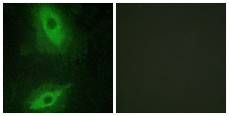 TNFSF15 / TL1A / VEGI Antibody - Immunofluorescence analysis of HeLa cells, using TNFSF15 Antibody. The picture on the right is blocked with the synthesized peptide.