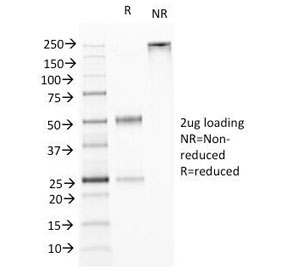 TNFSF15 / TL1A / VEGI Antibody - SDS-PAGE Analysis of Purified, BSA-Free TL1A Antibody (clone VEGI/1283). Confirmation of Integrity and Purity of the Antibody.