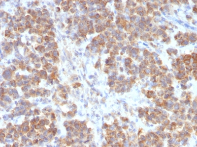 TNFSF15 / TL1A / VEGI Antibody - Formalin-fixed, paraffin-embedded human Parathyroid Mass stained with VEGI Rabbit Recombinant Monoclonal Antibody (VEGI /2052R).