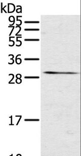 TNFSF15 / TL1A / VEGI Antibody - Western blot analysis of Mouse kidney tissue, using TNFSF15 Polyclonal Antibody at dilution of 1:600.