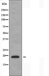 TNFSF15 / TL1A / VEGI Antibody - Western blot analysis of extracts of COLO205 cells using TNFSF15 antibody.