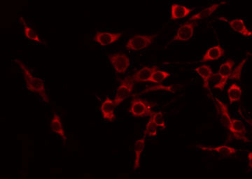 TNFSF15 / TL1A / VEGI Antibody - Staining COLO205 cells by IF/ICC. The samples were fixed with PFA and permeabilized in 0.1% Triton X-100, then blocked in 10% serum for 45 min at 25°C. The primary antibody was diluted at 1:200 and incubated with the sample for 1 hour at 37°C. An Alexa Fluor 594 conjugated goat anti-rabbit IgG (H+L) Ab, diluted at 1/600, was used as the secondary antibody.