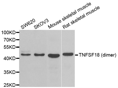 TNFSF18 / GITRL Antibody - Western blot analysis of extracts of various cell lines.