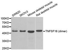 TNFSF18 / GITRL Antibody - Western blot analysis of extracts of various cell lines.