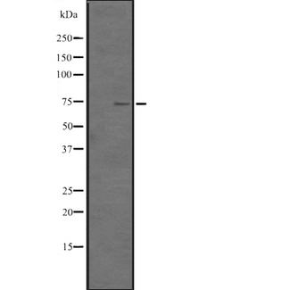 TNFSF18 / GITRL Antibody - Western blot analysis of TNF18 expression in HEK293 cells. The lane on the left is treated with the antigen-specific peptide.