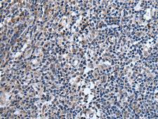 TNFSF18 / GITRL Antibody - Immunohistochemistry of paraffin-embedded Human tonsil tissue  using TNFSF18 Polyclonal Antibody at dilution of 1:45(×200)