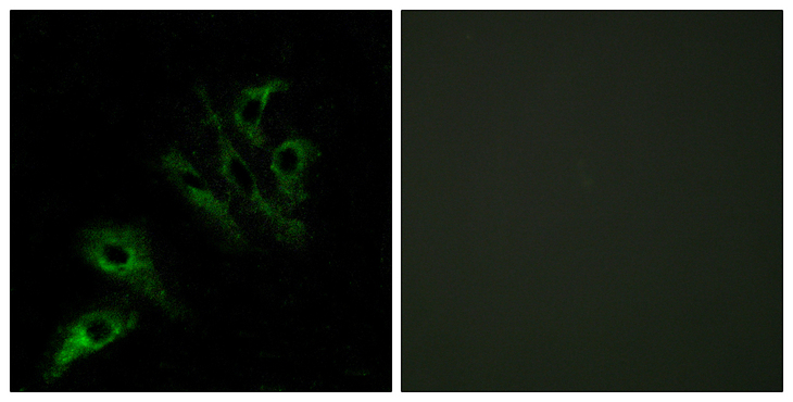 TNFSF4 / OX40L / CD252 Antibody - Immunofluorescence analysis of HeLa cells, using TNFL4 Antibody. The picture on the right is blocked with the synthesized peptide.