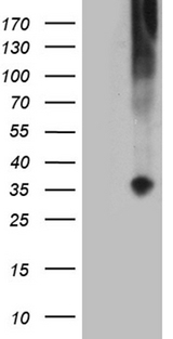 TNFSF4 / OX40L / CD252 Antibody - HEK293T cells were transfected with the pCMV6-ENTRY control. (Left lane) or pCMV6-ENTRY TNFSF4. (Right lane) cDNA for 48 hrs and lysed