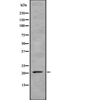 TNFSF4 / OX40L / CD252 Antibody - Western blot analysis of TNFSF4 using COS7 whole lysates.