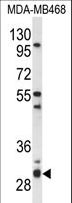 TNFSF5IP1 / CLAST3 Antibody - Western blot of PSMG2 Antibody in MDA-MB468 cell line lysates (35 ug/lane). PSMG2 (arrow) was detected using the purified antibody.