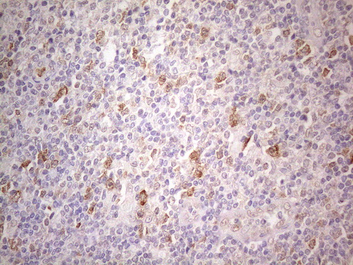 TNFSF5IP1 / CLAST3 Antibody - Immunohistochemical staining of paraffin-embedded Human lymph node tissue within the normal limits using anti-PSMG2 mouse monoclonal antibody. (Heat-induced epitope retrieval by 1mM EDTA in 10mM Tris buffer. (pH8.5) at 120°C for 3 min. (1:150)