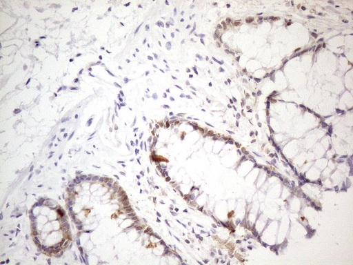TNFSF5IP1 / CLAST3 Antibody - Immunohistochemical staining of paraffin-embedded Human colon tissue within the normal limits using anti-PSMG2 mouse monoclonal antibody. (Heat-induced epitope retrieval by 1mM EDTA in 10mM Tris buffer. (pH8.5) at 120°C for 3 min. (1:150)