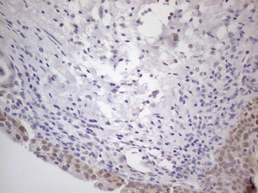 TNFSF5IP1 / CLAST3 Antibody - Immunohistochemical staining of paraffin-embedded Human bladder tissue within the normal limits using anti-PSMG2 mouse monoclonal antibody. (Heat-induced epitope retrieval by 1mM EDTA in 10mM Tris buffer. (pH8.5) at 120°C for 3 min. (1:150)