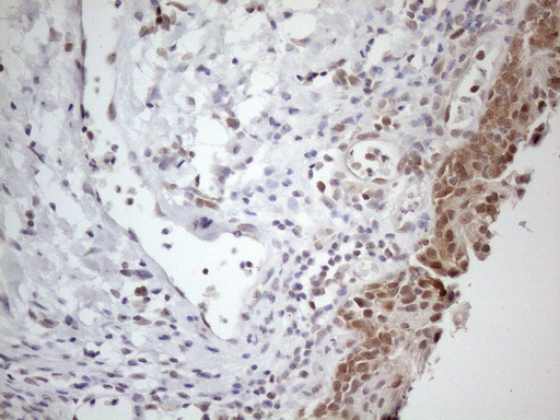 TNFSF5IP1 / CLAST3 Antibody - Immunohistochemical staining of paraffin-embedded Human bladder tissue within the normal limits using anti-PSMG2 mouse monoclonal antibody. (Heat-induced epitope retrieval by 1mM EDTA in 10mM Tris buffer. (pH8.5) at 120°C for 3 min. (1:150)