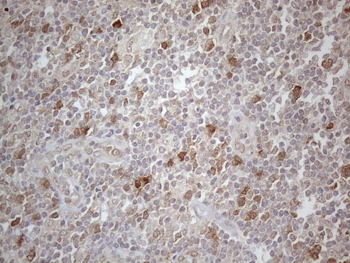 TNFSF5IP1 / CLAST3 Antibody - Immunohistochemical staining of paraffin-embedded Human lymph node tissue within the normal limits using anti-PSMG2 mouse monoclonal antibody. (Heat-induced epitope retrieval by 1mM EDTA in 10mM Tris buffer. (pH8.5) at 120°C for 3 min. (1:150)