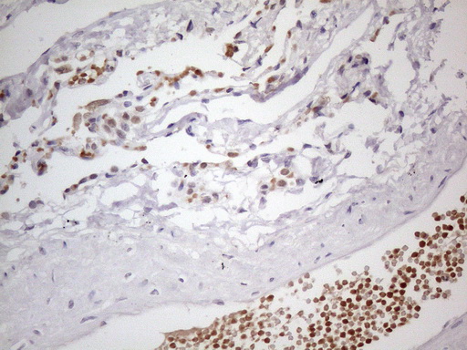 TNFSF5IP1 / CLAST3 Antibody - Immunohistochemical staining of paraffin-embedded Human lung tissue within the normal limits using anti-PSMG2 mouse monoclonal antibody. (Heat-induced epitope retrieval by 1mM EDTA in 10mM Tris buffer. (pH8.5) at 120°C for 3 min. (1:150)