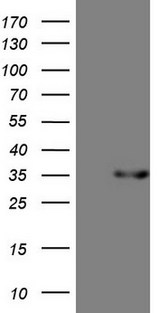 TNFSF5IP1 / CLAST3 Antibody - HEK293T cells were transfected with the pCMV6-ENTRY control. (Left lane) or pCMV6-ENTRY PSMG2. (Right lane) cDNA for 48 hrs and lysed. Equivalent amounts of cell lysates. (5 ug per lane) were separated by SDS-PAGE and immunoblotted with anti-PSMG2.