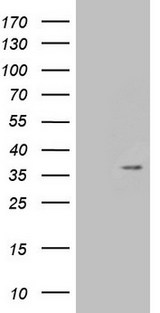 TNFSF5IP1 / CLAST3 Antibody - HEK293T cells were transfected with the pCMV6-ENTRY control. (Left lane) or pCMV6-ENTRY PSMG2. (Right lane) cDNA for 48 hrs and lysed. Equivalent amounts of cell lysates. (5 ug per lane) were separated by SDS-PAGE and immunoblotted with anti-PSMG2. (1:2000)