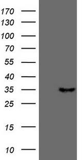 TNFSF5IP1 / CLAST3 Antibody - HEK293T cells were transfected with the pCMV6-ENTRY control. (Left lane) or pCMV6-ENTRY PSMG2. (Right lane) cDNA for 48 hrs and lysed. Equivalent amounts of cell lysates. (5 ug per lane) were separated by SDS-PAGE and immunoblotted with anti-PSMG2. (1:500)