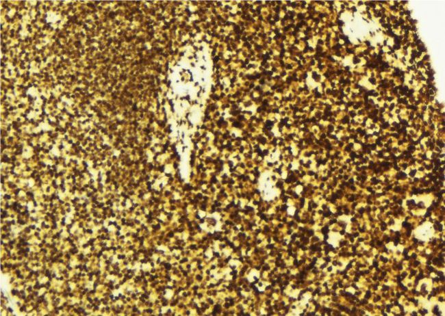TNFSF5IP1 / CLAST3 Antibody - 1:100 staining mouse spleen tissue by IHC-P. The sample was formaldehyde fixed and a heat mediated antigen retrieval step in citrate buffer was performed. The sample was then blocked and incubated with the antibody for 1.5 hours at 22°C. An HRP conjugated goat anti-rabbit antibody was used as the secondary.